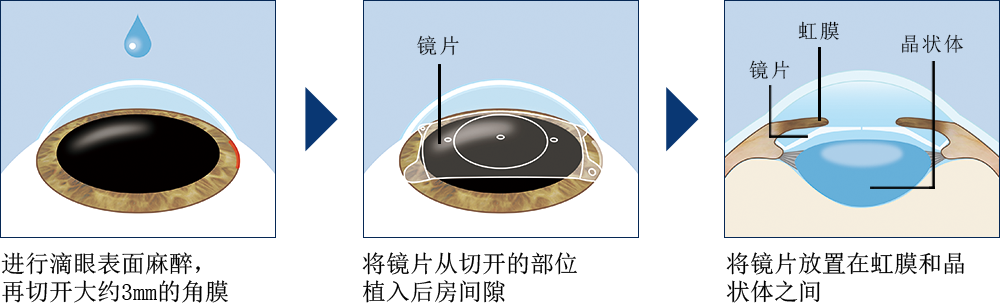 手术过程
