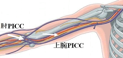 Picc外来 消化器センター 消化器内科 消化器外科 診療科のご案内 ご来院の方へ 医療法人財団順和会 山王病院